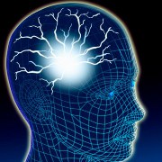 Brain Aneurysm related image